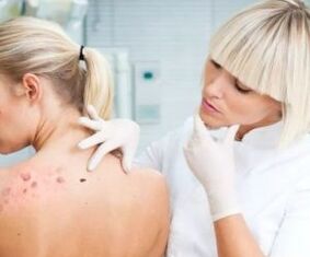 Symptome des menschlichen Papillomvirus