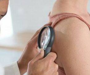 wie man das menschliche Papillomvirus bestimmt